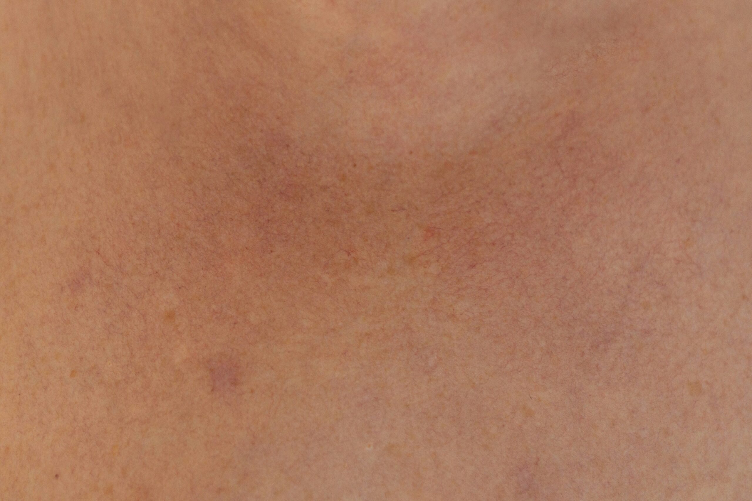 Before and after photos showing improved skin texture after using organic vegetable skincare