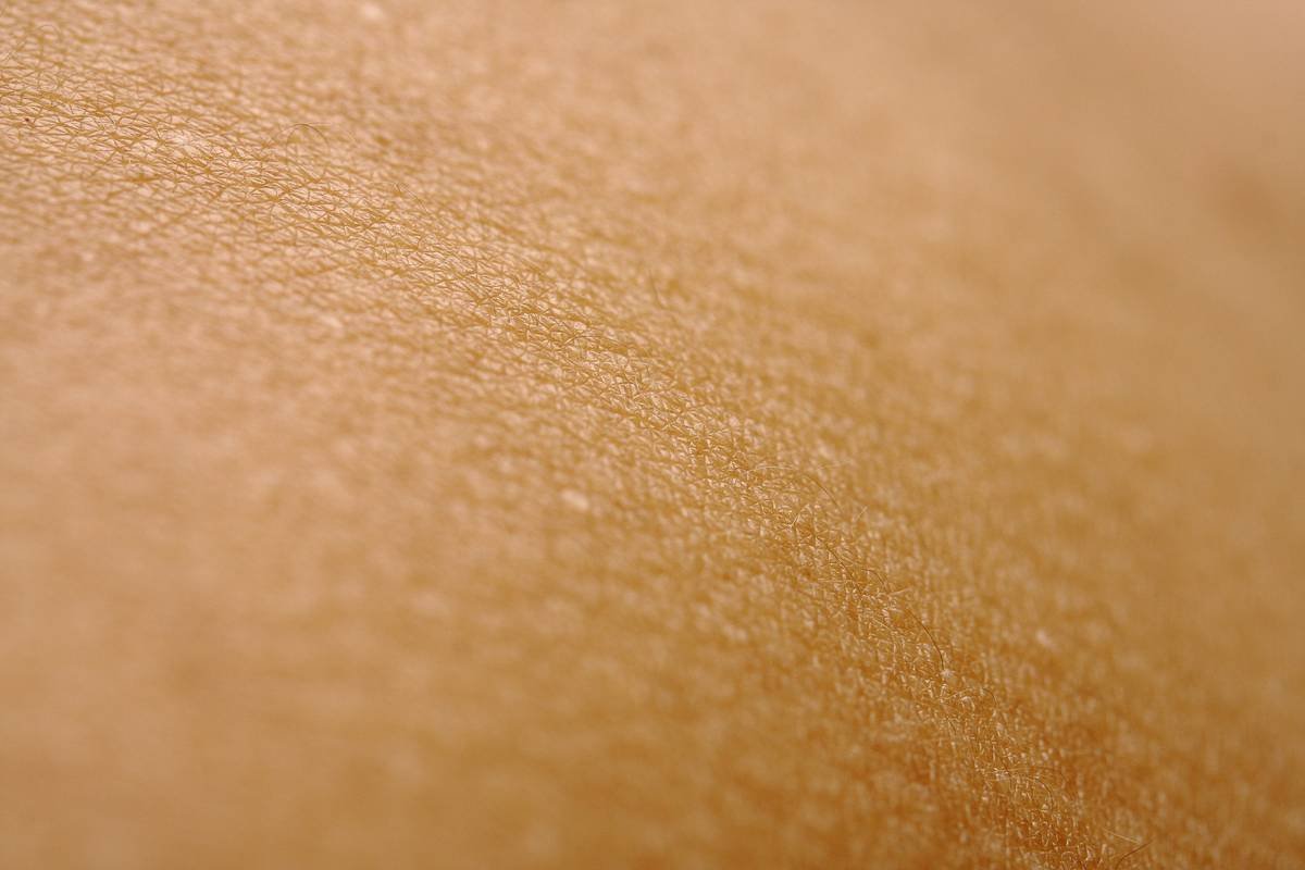 Before and after images showing the transformation of Sarah's skin, from dry and acne-prone to smooth and glowing.